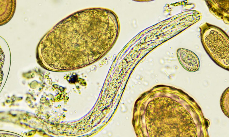 Parasiten im Darm