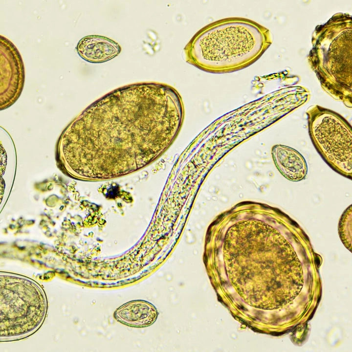 Parasiten im Darm